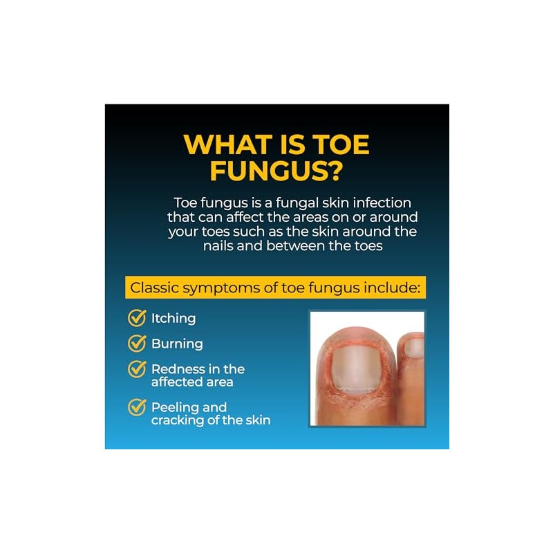 Fungi Nail 1oz Solution, With Brush