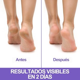 Podovis | Crema para Pies Regeneradora de Talones Agrietados | Crema para los Pies | Crema para pies para callos| Crema para Pies Hidratante| Crema pa