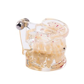 Easyinsmile Dental Alternating Pathological Modelfor Dentist Studying Researching and Patient Education