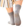Sun Knit Slippery Socks, Smooth Socks, Heel + Soles, Cracking,