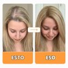 Vytadose Parches multivitamínicos | Crecimiento del cabello para mujeres |
