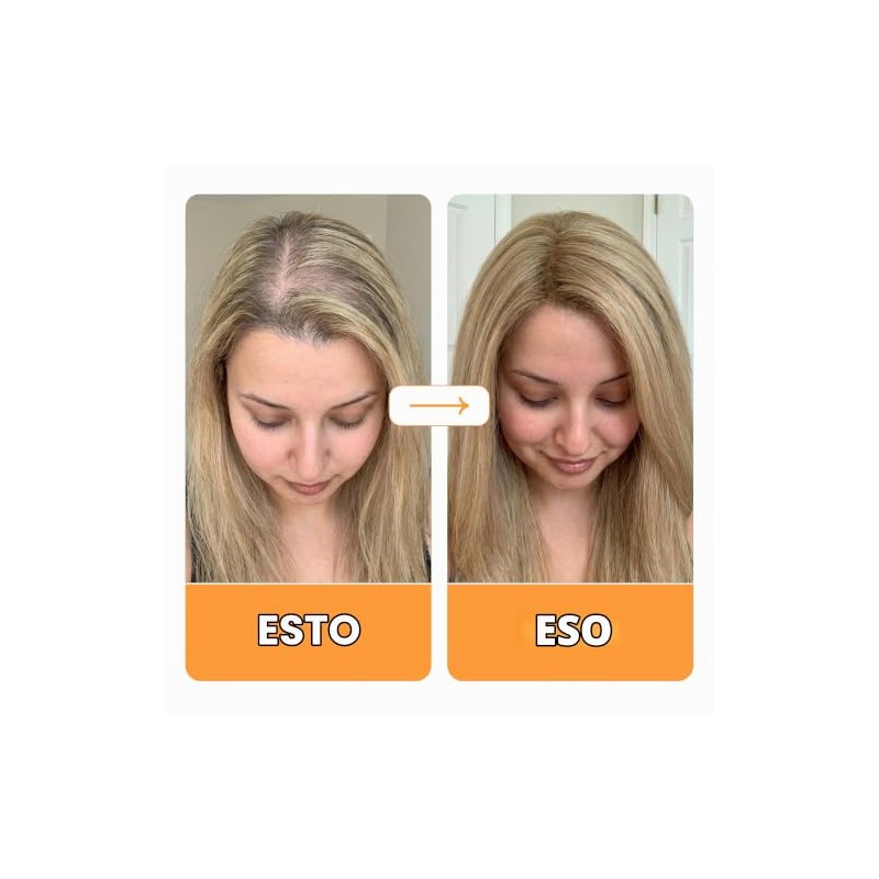 Vytadose Parches multivitamínicos | Crecimiento del cabello para mujeres |
