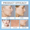 3PCS Hydrating Face Moisturizer with Niacinamide Repair Skin Barrier Day