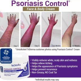 TriDerma Psoriasis Control Face & Body Cream, No Cortisone, Moisturizing 8oz Jar