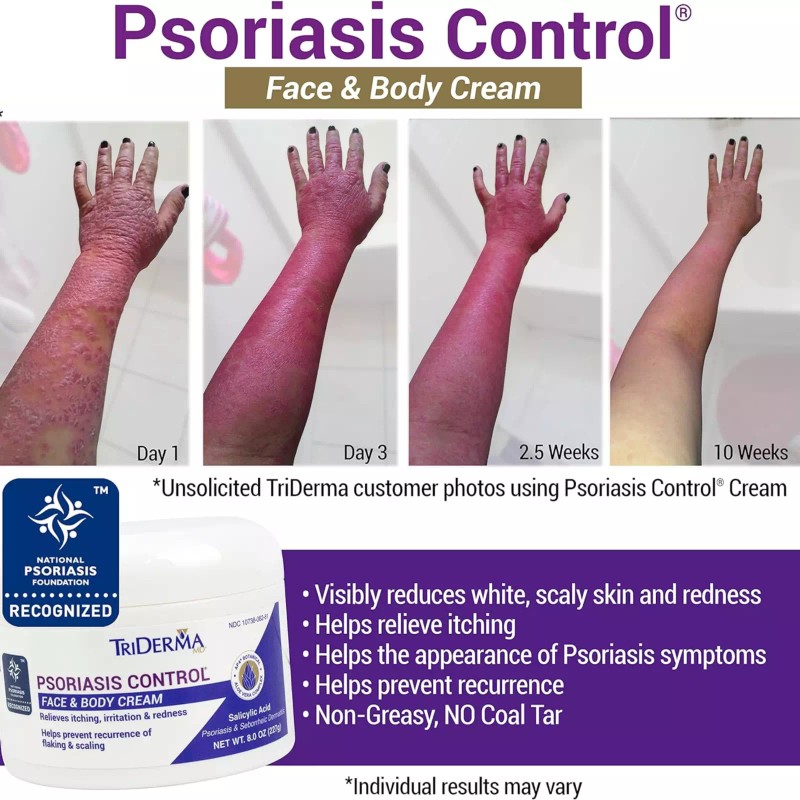 TriDerma Psoriasis Control Face & Body Cream, No Cortisone, Moisturizing