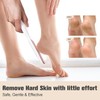findqiao Glass foot file and callus remover, highly effective hard