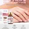 Dark Knuckle Whitening Serum, Whitening Serum Hand Knuckle Glow Serum