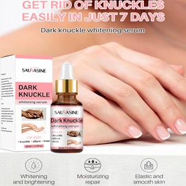 Dark Knuckle Whitening Serum, Whitening Serum Hand Knuckle Glow Serum for Removing Dark Knuckle Elbow, Brighter, Moisturizing, Exfoliates - 30ml (1PC)