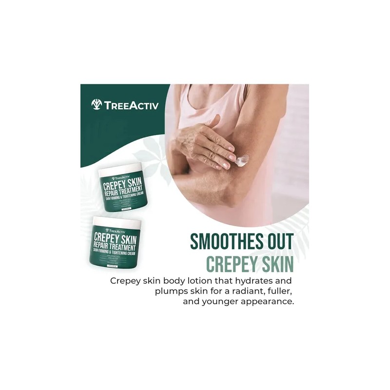 Treeactiv Crepey Skin Repair Treatment, 8oz, Crema Reafirman