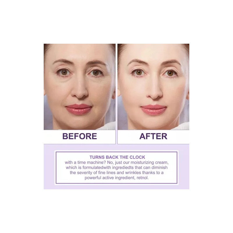Crema Rejuvenece Antiedad Retinol 2.5% Aloe Vera Antiarrugas