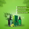 Original Neo Hair Lotion 120ml With Derma Roller Effective Hair