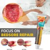 Scar Cream for Pressure Points, Soothing Cream for Pressure Points,