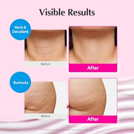EQQUALBERRY NAD+ Peptide Boosting Cream – NAD+ 5% & 13 Peptides Anti-Aging Korean Skincare Face & Body Cream | Firming & Lifting Pink Neck Cream for S