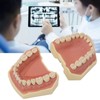 Dental Teaching Model Soft Gum 32 Teeth Dental Demonstration Teeth