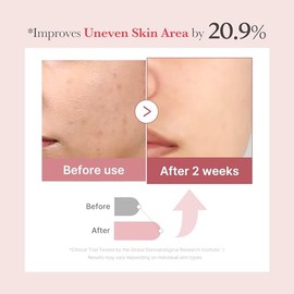 PDRN PINK EXOSOME SHOT SERUM 7500 30ml