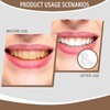 3 Pcs Clip in Veneers Teeth, Clip On Veneers Top