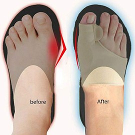 HiiBaby 2 separadores de dedos hallux valgus corrector ortopédico corrector ortopédico corrector ortopédico corrección de pedicura calcetín alisador