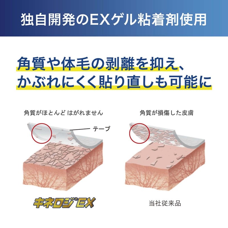 NITREAT NKEX-75 Kinelogy EX 3.0 inches (75 mm) x 16.4
