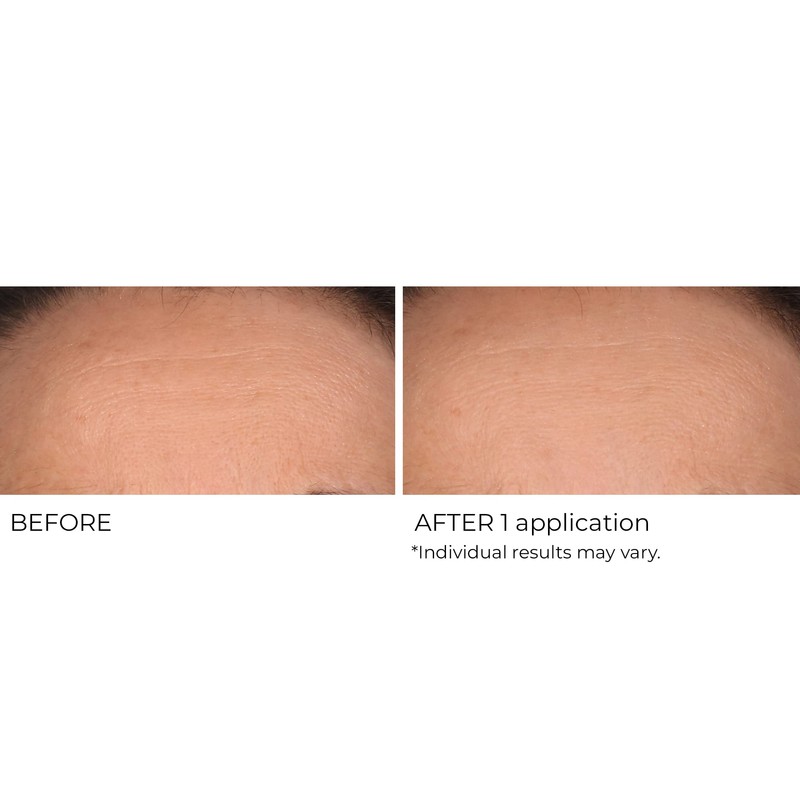 NassifMD Wrinkle Blur Targeted Treatment