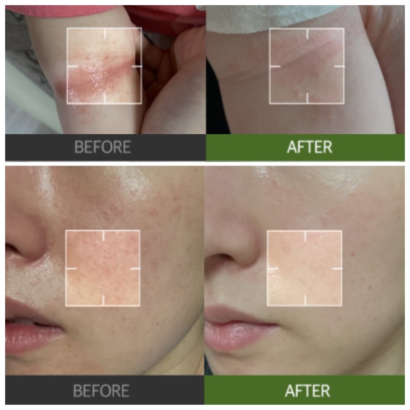 RBFY Daily Ampoule Pad 170ml 100pads