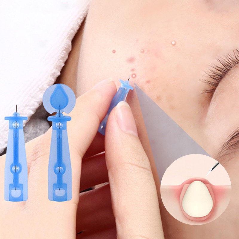 Pack of 100 Blackhead Remover, Disposable Acne Pimple Needles, ABS