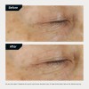 Revision Skincare D.e.j Eye Cream, Hidratante Integral Con