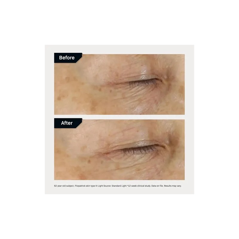 Revision Skincare D.e.j Eye Cream, Hidratante Integral Con