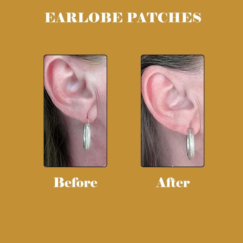 Aayuleubeda Badi Care ABC - Ear lobe support patch for