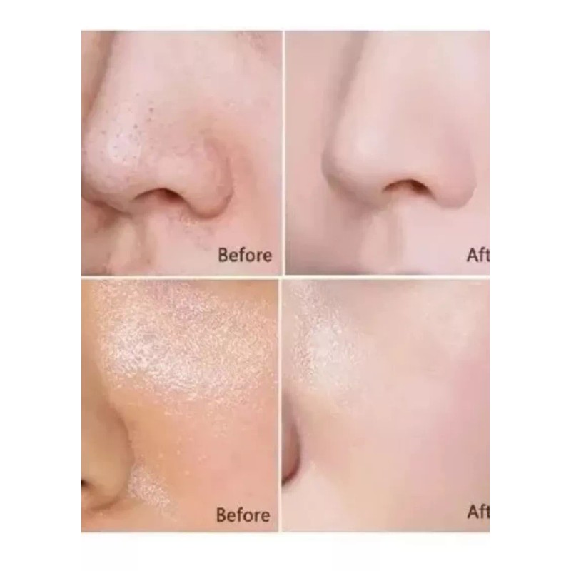 Totu 3 Pzas D Jabón De Arroz Tailandés, Aclara Y