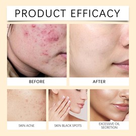 Rice And Honey Clay Mask - Moisturizing Face Masks Skincare - Facial Mask with Rice Extract and Honey - Hydrating Face Mask For Deep Cleansing, Reducing Pores & Acne - Face Masks Beauty For Women