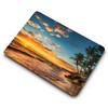Case Compatible with MacBook Pro 13 Inch 2015 2014 2013
