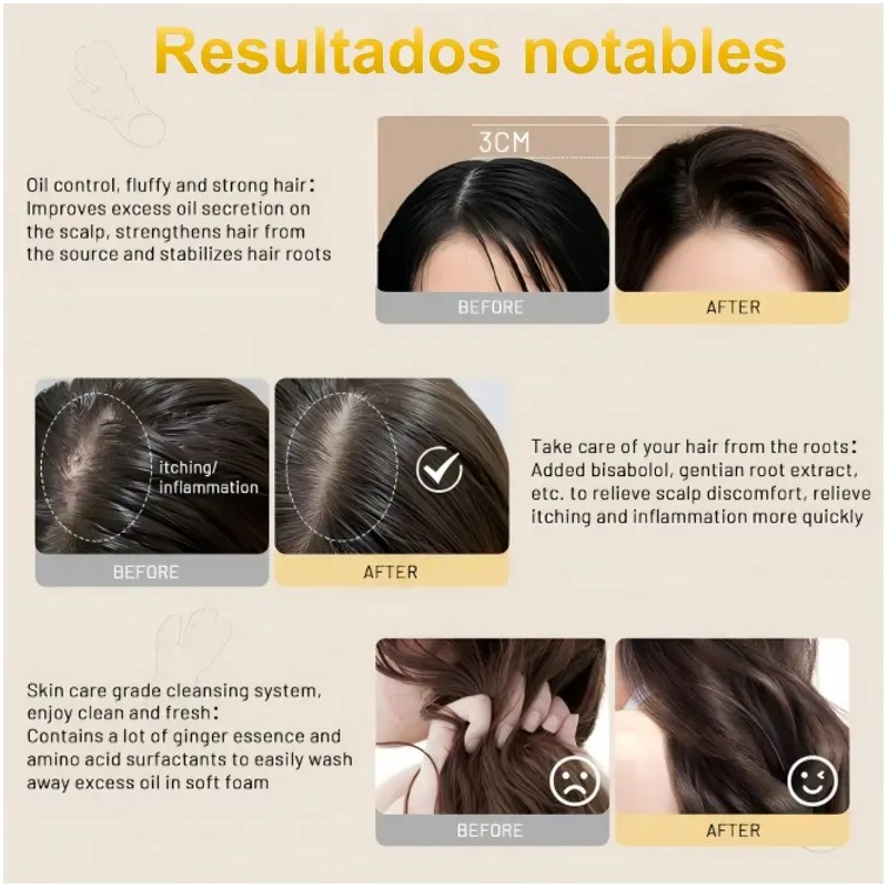 Natural Shampoo De Jengibre El Crecimiento Del Cabello 240ml