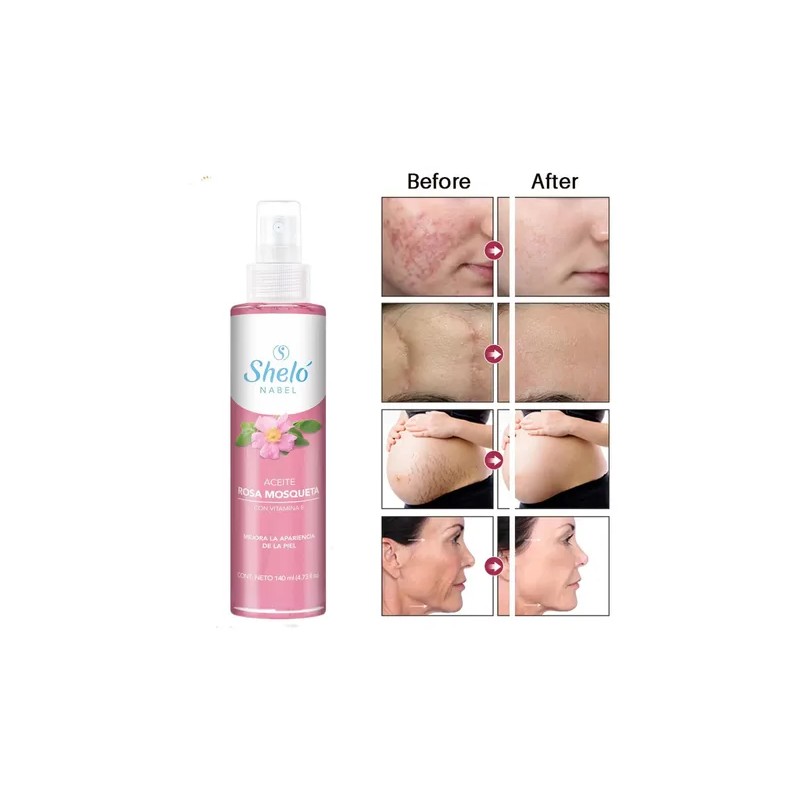 Aceite Rosa Mosqueta Sheló Nabel 140ml Antiarrugas Antiedad