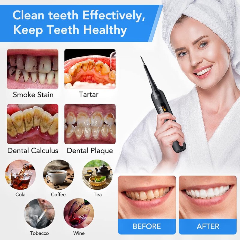Electric Dental Calculus Tartar Remover High-Frequency Vibration Tartar Scraper Remover