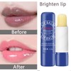 Sale!! Remove Dark Lip Balm Lighten Melanin Keeping Elasticlip Mask