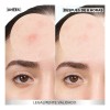 Parche Parches Acné Invisibles Pimple