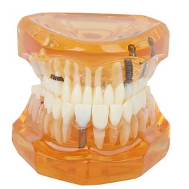 1pc Orange Color Dental Disease Removable Study Teaching Teeth Model