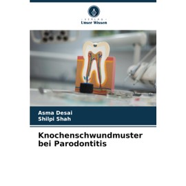 Knochenschwundmuster bei Parodontitis: DE