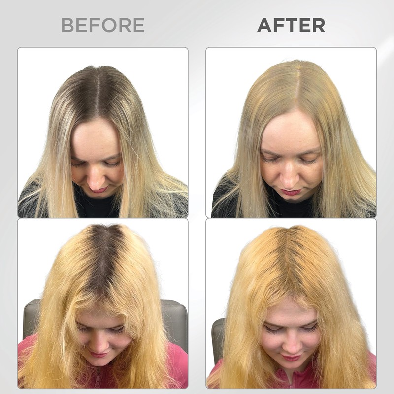 THICK FIBER Root Powder - Hair Concealer for Hair Thickening