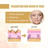 Nasolabial Wrinkle Patch with Gold, Anti-Wrinkle Plasters, Hyaluronic Acid Lifting