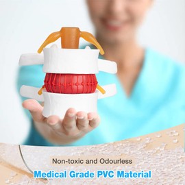 faruijie Anatomical Lumbar Vertebral Model - 1.5X Human Lumbar Disc Herniation Demonstration Model Disc Herniation Model Intervertebral Disc Model