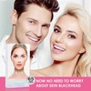 JOLVKA Blackhead Remover Pore Strips for Nose - 65 Strips
