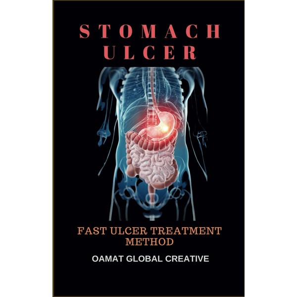 STOMACH ULCER: Fast ulcer treatment method, Ulcer guard for humans,