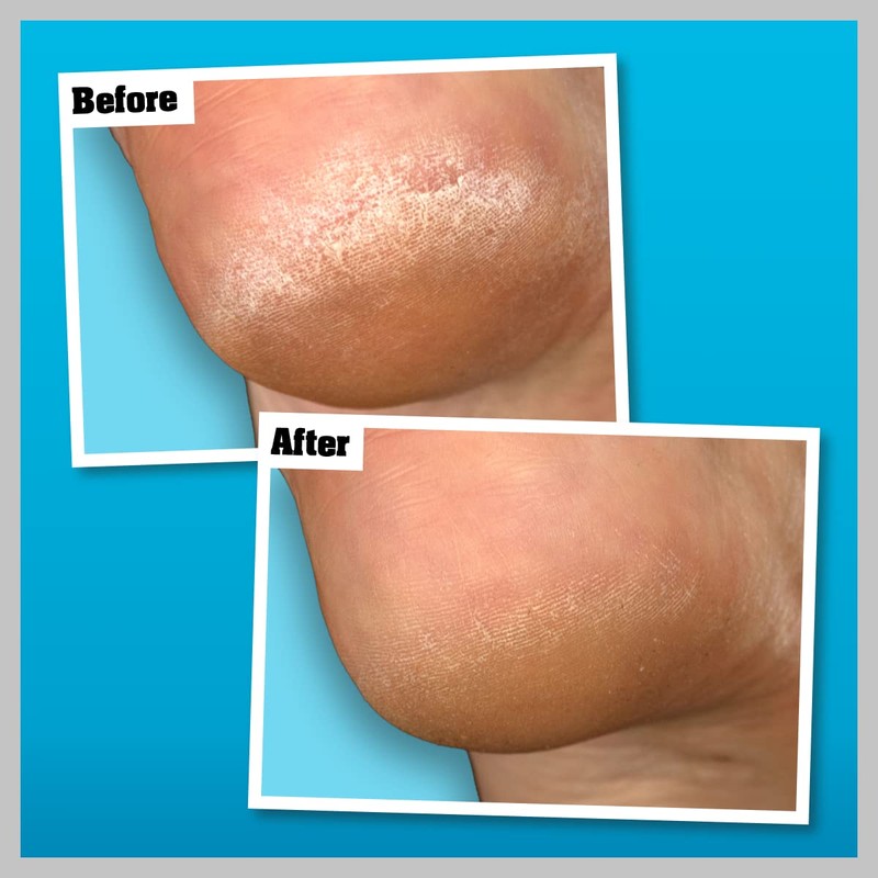 O’Keeffe’s Healthy Feet Overnight 80ml