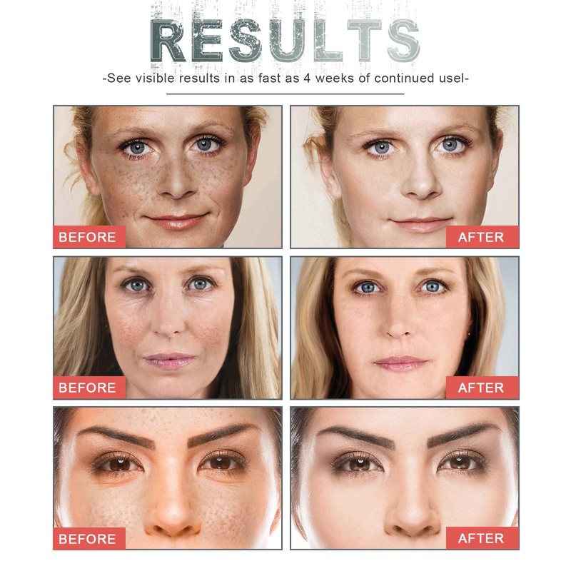 Anti Alterungs Creme, Sehr Trockene Haut, Anti-Aging-Pflege Gegen alle Alterserscheinungen