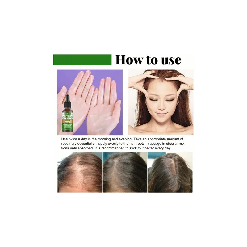 Sérum Capilar con Aceite de Romero 30ml – Crecimiento, Fortalecimiento