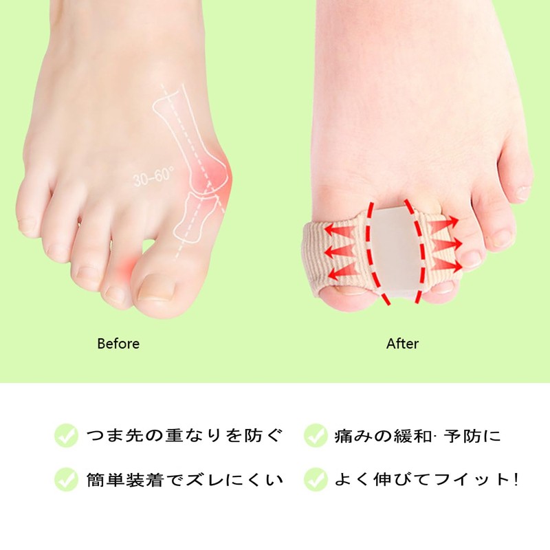 MZMSBAO 足指サポート 足指を広げる 足指サポーター お 睡眠足指ストレッチパッド、足指ストレッチパッド、ユニセックスで着脱が容易 2枚入り。 (L：25-28)