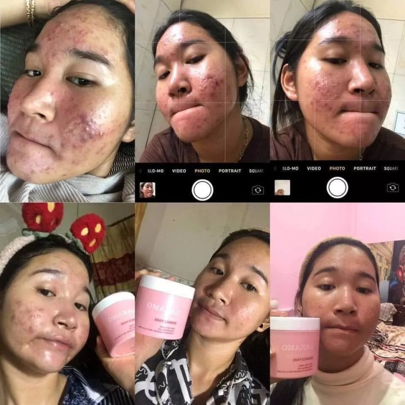 LAKAMO Pore Tightening Essence Pads សំឡីជូតមុខកូរ៉