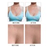 Cleavage Pads T Shaped Anti Wrinkle Silicone Cleavage Pads Self