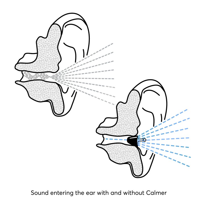 Flare Calmer Night – Sleeping Ear Plugs Alternative – Reduce